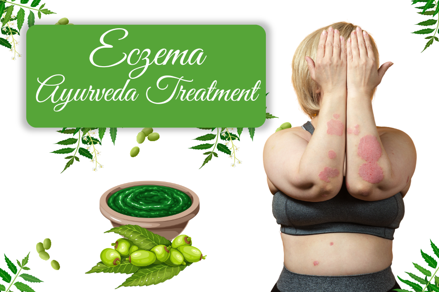 Eczema Ayurvedic Treatment