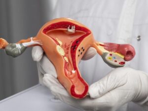 Ayurvedic Treatment for Fallopian Tubal Blockage